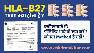 HLA-B27 टेस्ट की पूरी जानकारी|Hla b27 का Ankylosing से क्या रिसता है|एचएलए मे कोनसे test कराने चाहिए