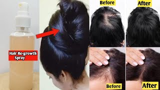 No Hair Loss!No Baldhead!Thick hair Forever!Diy hair growth sprey/Hair growth sprey/Hairgrowth tips