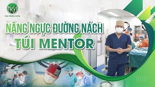 Nâng Ngực Đường Nách Túi Mentor | Bác Sĩ Ngô Mộng Hùng #ngomonghung