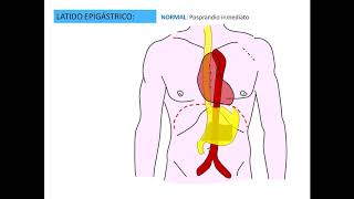 Latido epigástrico pptx