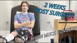 ACL Reconstruction Surgery: 2 Week Update