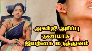 அலர்ஜி, அரிப்பு குணமாக இயற்கை மருத்துவம்  | remedy for skin allergy | Skin Allergy Treatment