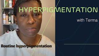 Tu souffres d’hyperpigmentation???