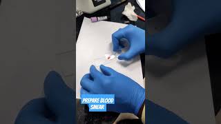 Prepare Blood Smear       #shortvideo #trending #viralvideo #lab #medical #medicalstudent #ytshorts