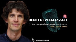 Denti Devitalizzati - L'ombra Nascosta di una terapia molto comune