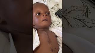 Baby born with three holes in the heart operated