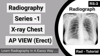 Radiography Series-1, X ray Chest AP View (Erect)/ RT-3