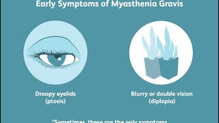 Fatigueable Ptosis and Extraocular Movement Restriction in Myasthenia Gravis🧠🧠