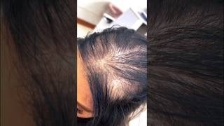 شنیون موی کم حجم Low volume hair clip #hairdresser #hair #hairstylehairstyle #hairtutorial