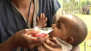 HealthPhone™ English - 5 Appetite Testing Techniques - Management of Severe Acute Malnutrition