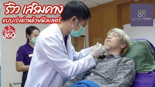 เสริมคางที่ Goodwill Clinic แบบเร่งด้วนด้วย Filler  #ฉีดฟิลเลอร์ที่ไหนดี #GoodwillClinic #เสริมคาง