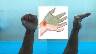 تمارين لعلاج الم وتنميل اليد |Exercise for carpal tunnel syndrome