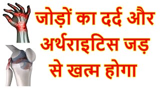 गठिया का रामबाण इलाज | गठिया के घरेलू उपचार | गठिया को जड़ से खत्म करने के उपाय | गठिया रोग के उपाय