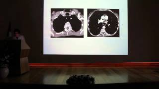 Oesophagus diseases - Naama BOGOT Part 1