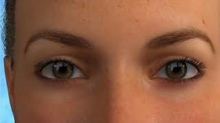 Blepharoplasty Animation