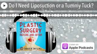 Do I Need Liposuction or a Tummy Tuck?