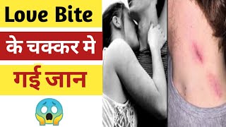 Love Bite के चक्कर में गयी जान | Short Video | By GP Knowledge