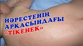 НӘРЕСТЕНІҢ АРҚАСЫНДАҒЫ "ТІКЕНЕК"