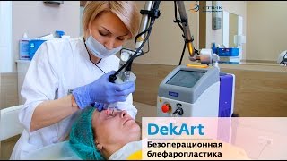 Безоперационная блефаропластика DekArt