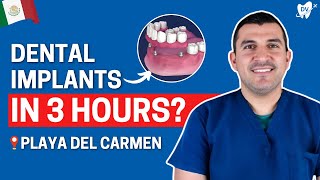 Dental Implants in Playa del Carmen, Mexico: Top Brands & Timeline!