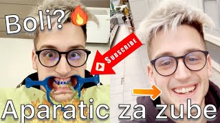 APARATIC ZA ZUBE(Reakcija prijatelja)