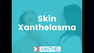 Skin Xanthelasma - Suffering from Skin Xanthelasma ?, We can help to get them removed.