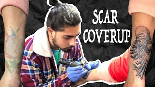 SCAR COVERUP TATTOO - ABHIINKZONE TATTOOS