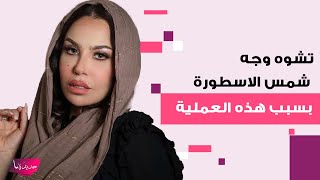 تشـ ـوه وجه شمس الاسطورة بعد عملية تجميل فاشلة والجمهور يشبهها بـ مايكل جاكسون