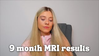 brain cancer update... MRI results, clinical trial and where my tumour is