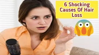 6 Shocking Causes Of Hair Loss || बालों के झड़ने के 6 चौंकाने वाले कारण | |