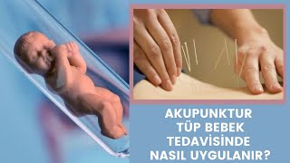 Akupunktur Tüp Bebek Tedavisinde Nasıl Uygulanır? Op. Dr. Didem Kurban