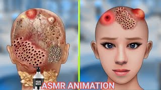 asmr ear cleaning | ASMR animation treatmentmindfulness