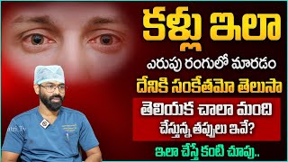 How to Reduce Eye Redness | Tips to Cure Eye Infection | Eye Health | Goutham Reddy  | Dhatri TV