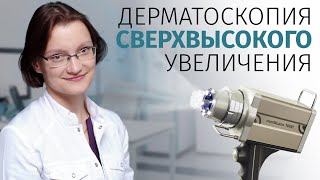 Оптическая дерматоскопия сверхвысокого увеличения