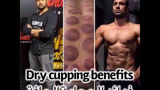 فوائد الحجامة الجافة | benefits of dry cupping