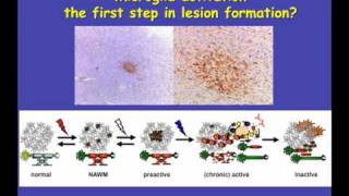 Sandra Amor PART 4-The Role of Macrophage Activation in Lesion Formation