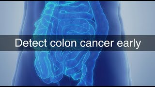 Health Tip | Detect Colon Cancer. Early signs and symptoms