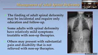 Strategies to Avoid Complications in Adult Spine Deformity Surgery with Guest Justin Smith, MD