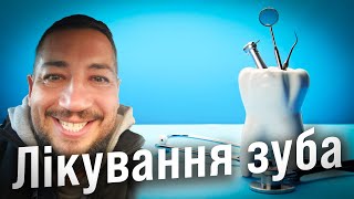 🦷 Парадантоз. Лікування зубів. Мій досвід 🦷