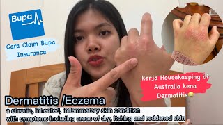 Curhat kena Dermatitis kerja Housekeeping di Australia 😭| Cara Claim Bupa Insurance | WHV Australia