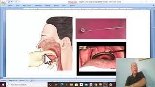 Surgical disorders of tongue and jaw  in Arabic 2 (Carcinoma of tongue, part 2) , by Dr. Wahdan