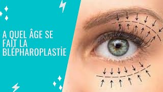 A quel âge se Fait La Blépharoplastie