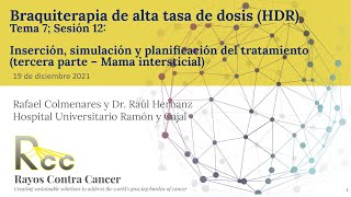 Sesión 12 - Inserción, simulación y planificación; Mama intersticial