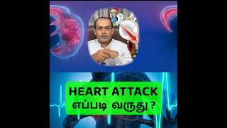 Heart attack எப்படி வருது ?Dr Sivaprakash