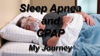 Sleep Apnea and CPAP-My Journey