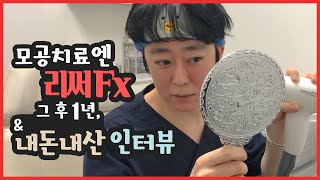 모공치료엔 리써Fx 그후 1년 & 내돈내산 리얼 인터뷰 by 닥터개굴 피부과전문의