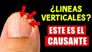 ¡Lo que tus uñas intentan decirte sobre tu SALUD!