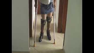 Polio Leg Brace Donnas cold shower on a hot day