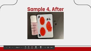 Blood Typing Lab