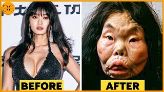 25 Famous Celebrities Who Ruined Their Faces with Plastic Surgery!